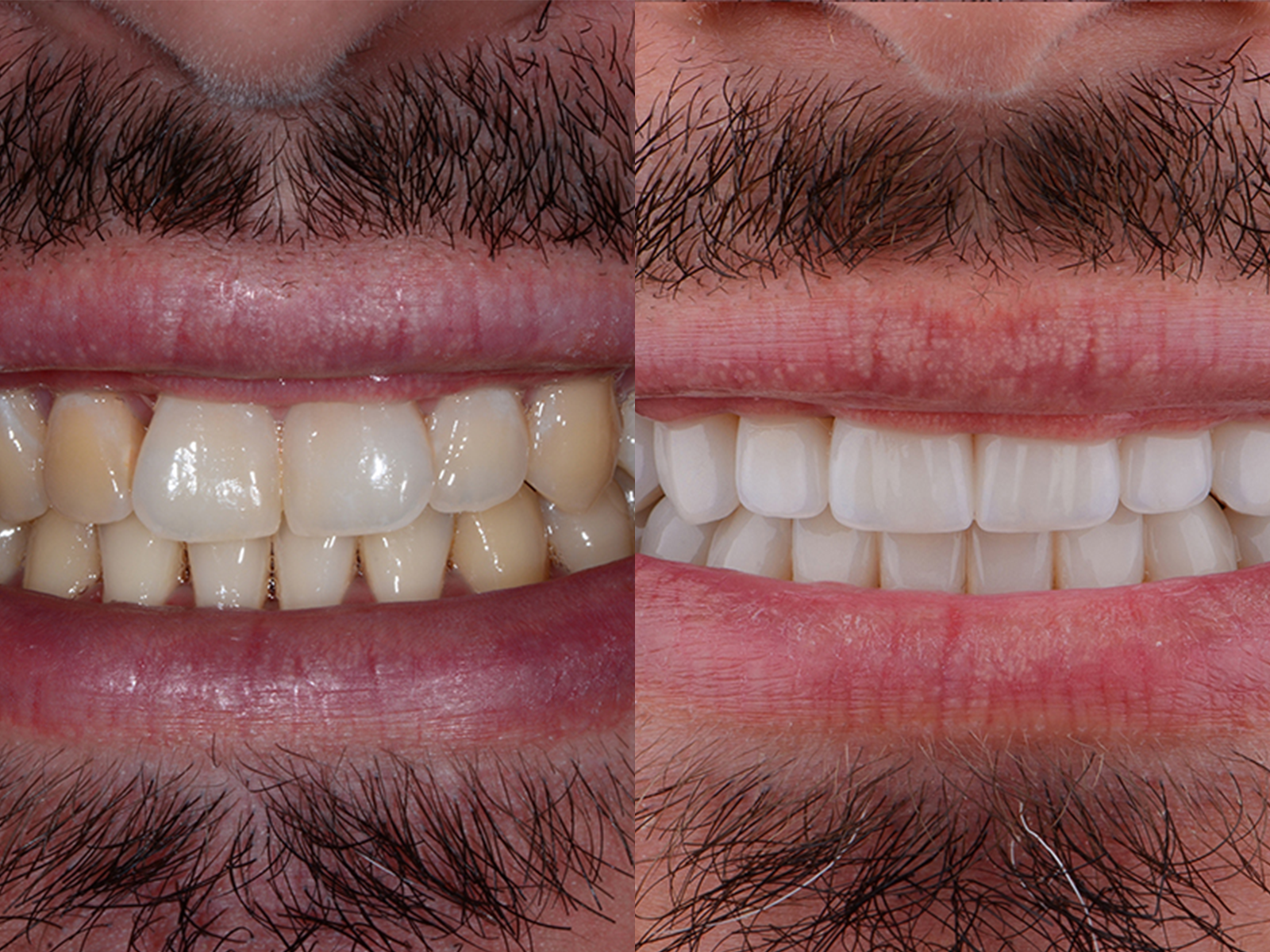 antes y despues